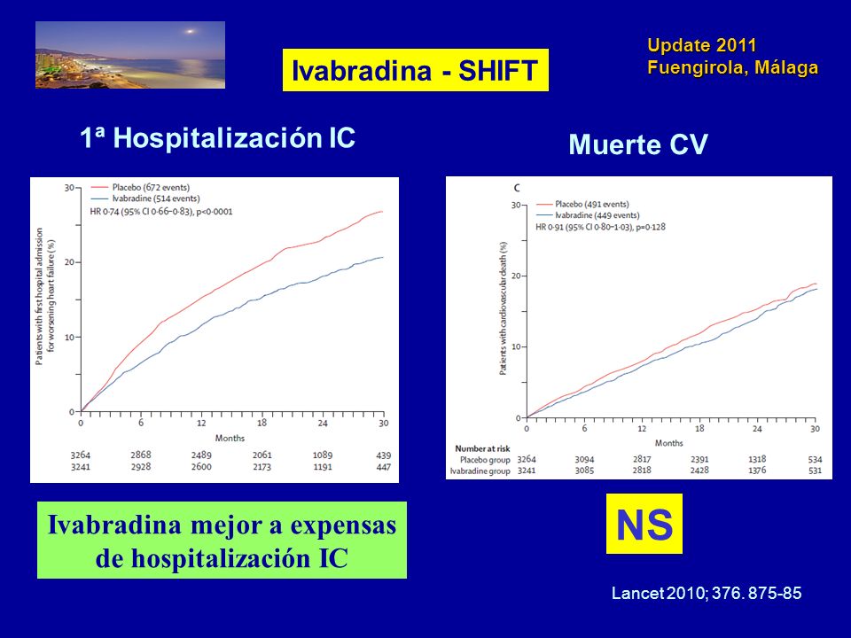 Ivabradina mejor a expensas de hospitalización IC