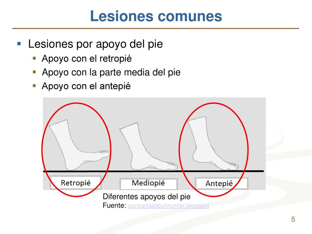Lesiones comunes Lesiones por apoyo del pie Apoyo con el retropié