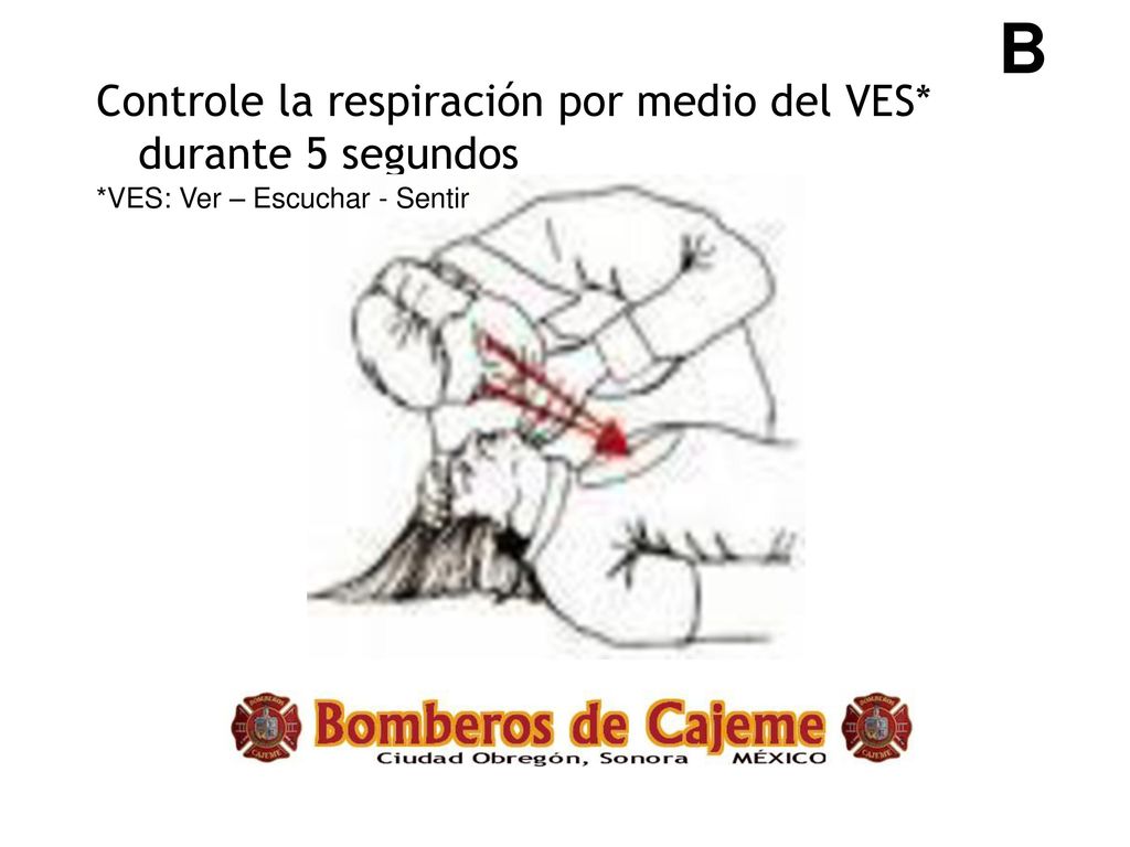 B Controle la respiración por medio del VES* durante 5 segundos