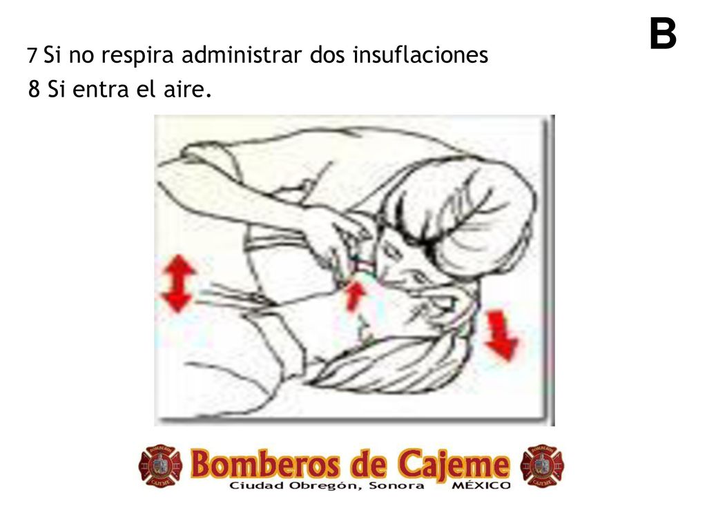 B 7 Si no respira administrar dos insuflaciones 8 Si entra el aire.