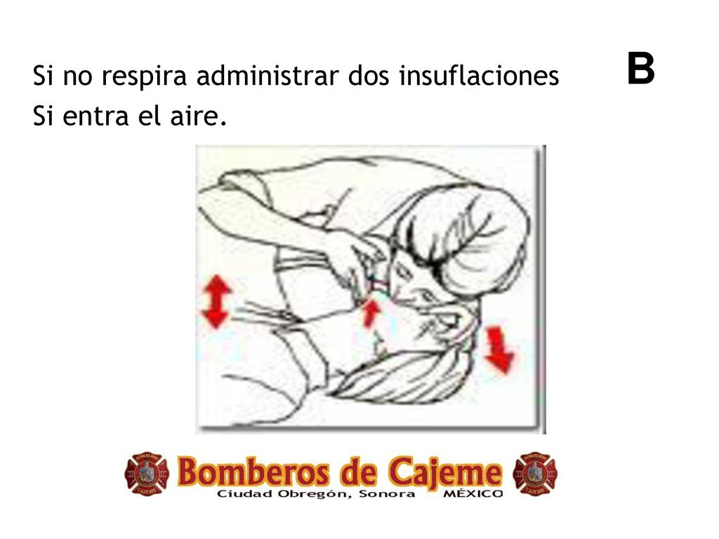 B Si no respira administrar dos insuflaciones Si entra el aire.