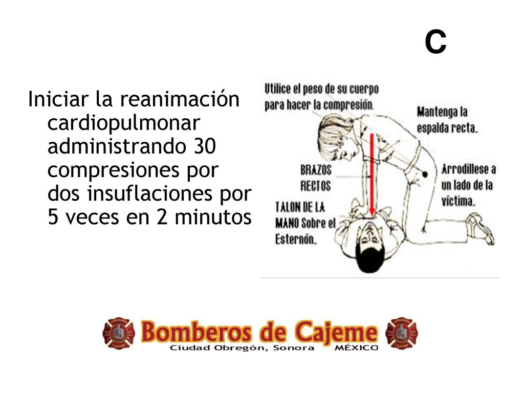 C Iniciar la reanimación cardiopulmonar administrando 30 compresiones por dos insuflaciones por 5 veces en 2 minutos.