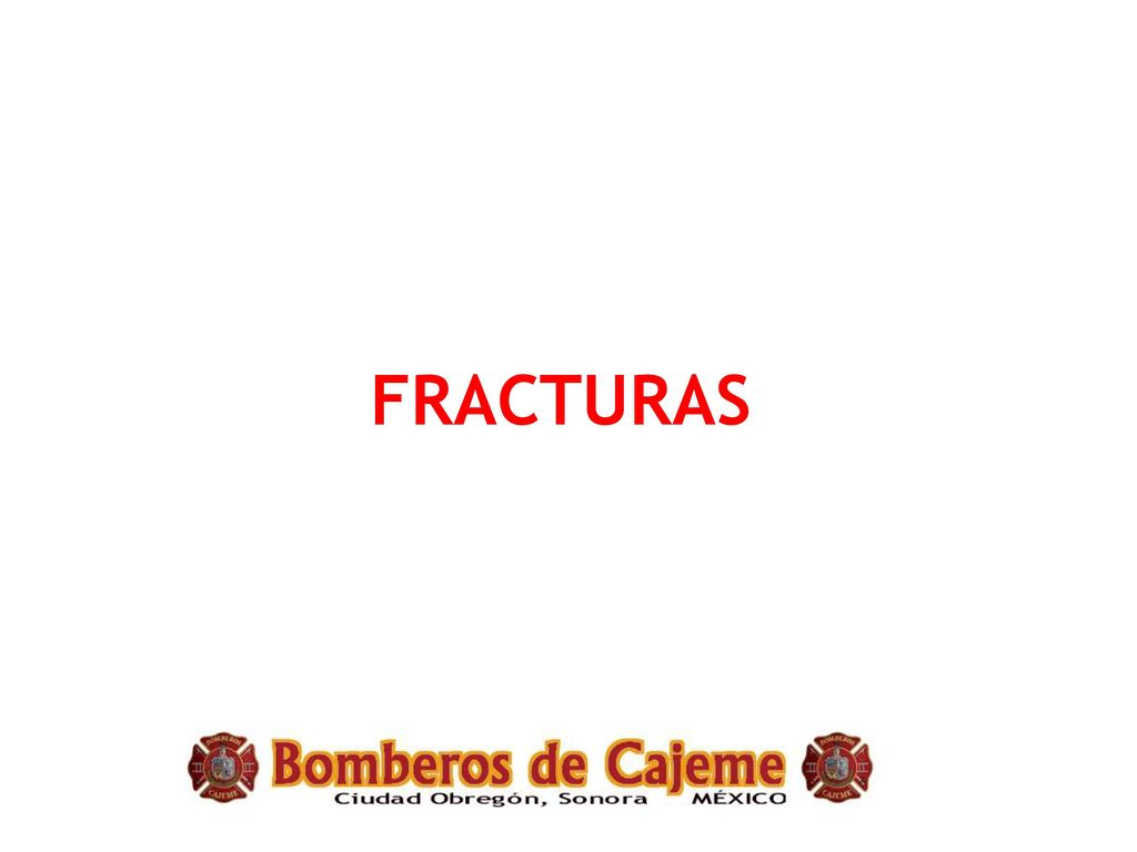 FRACTURAS