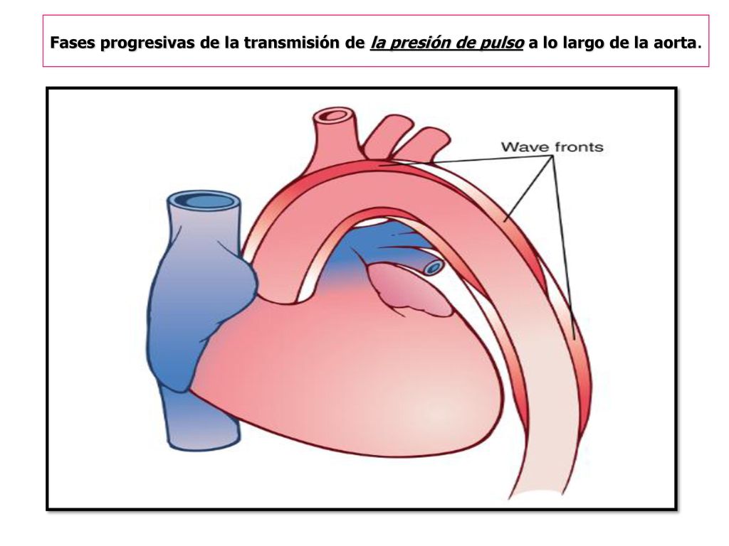 Fases progresivas de la transmisión de la presión de pulso a lo largo de la aorta.