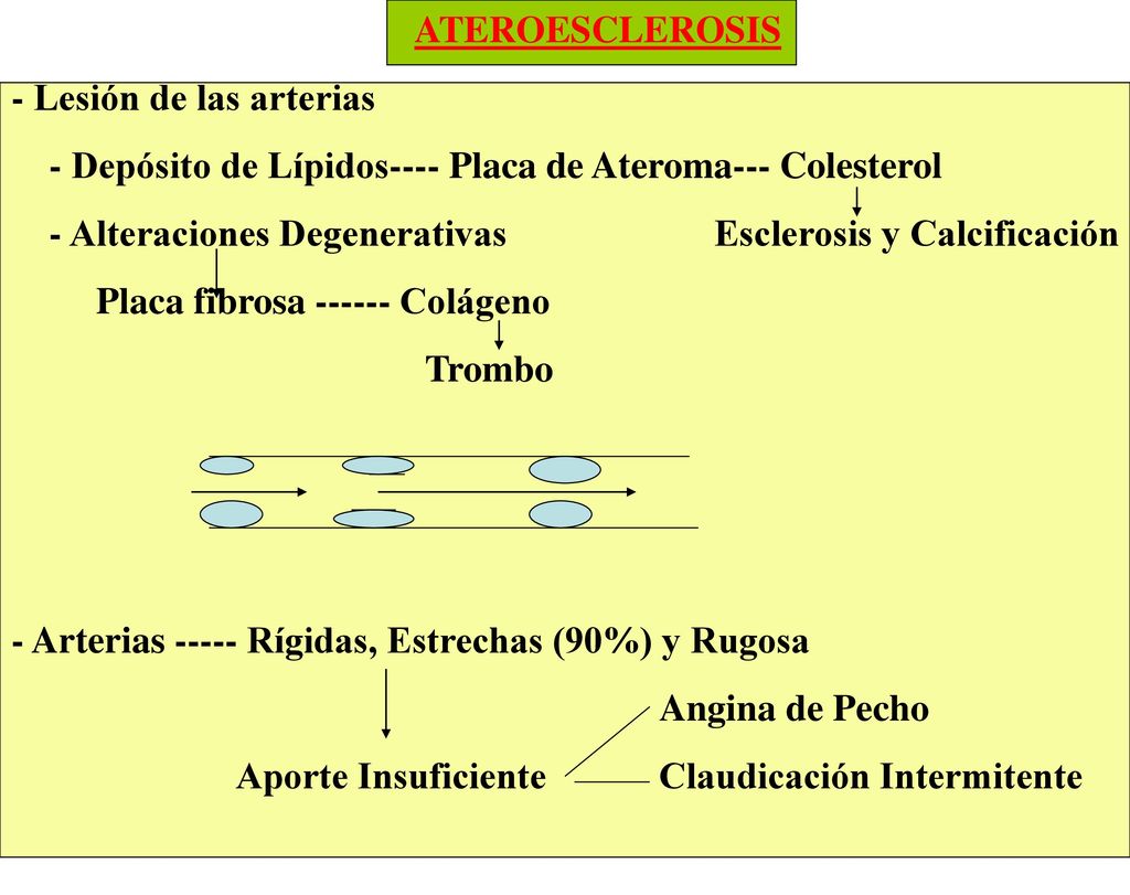 ATEROESCLEROSIS - Lesión de las arterias. - Depósito de Lípidos---- Placa de Ateroma--- Colesterol.