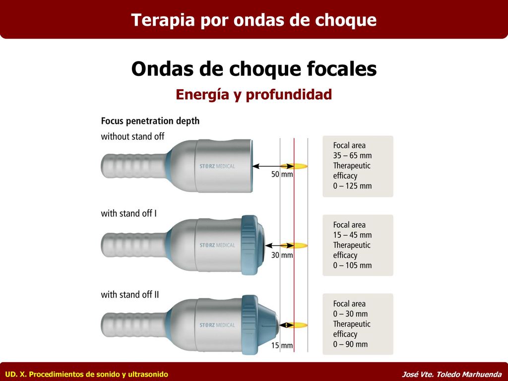 Terapia por ondas de choque Ondas de choque focales
