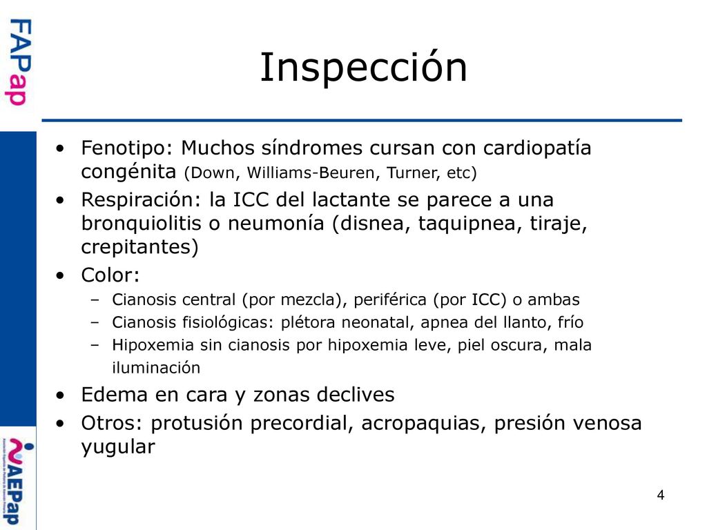 Inspección Fenotipo: Muchos síndromes cursan con cardiopatía congénita (Down, Williams-Beuren, Turner, etc)