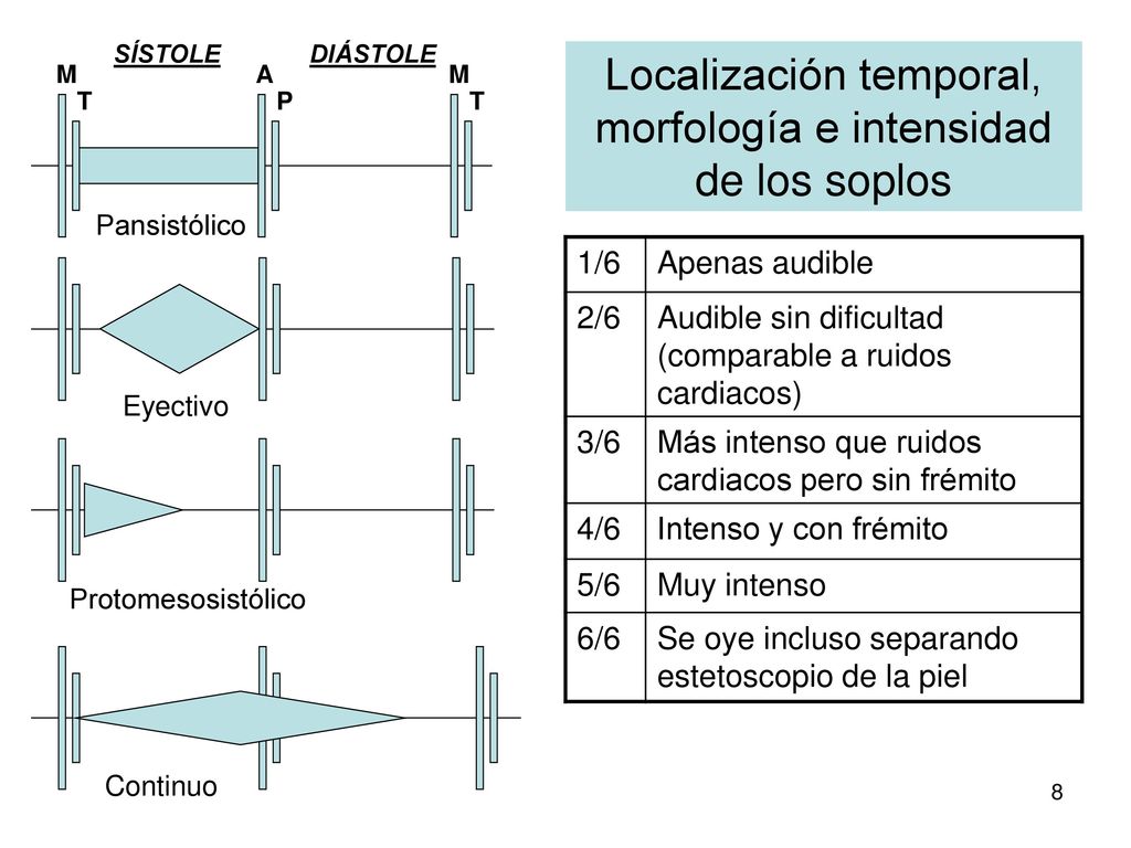 Localización temporal, morfología e intensidad de los soplos