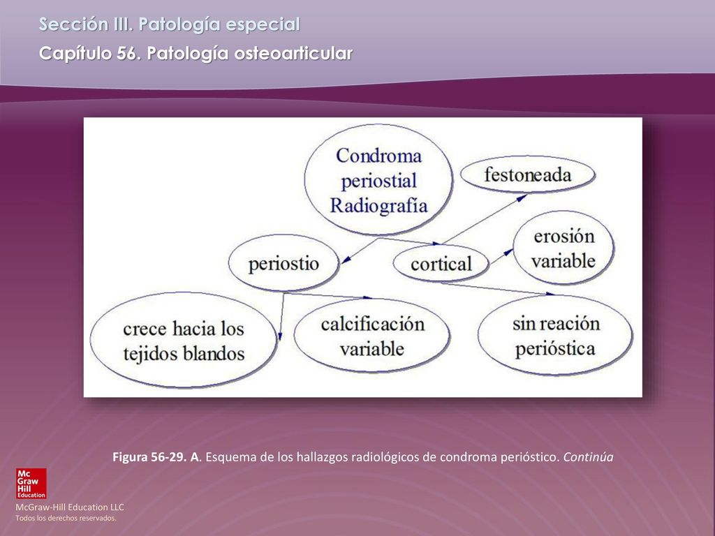 Figura A. Esquema de los hallazgos radiológicos de condroma perióstico. Continúa