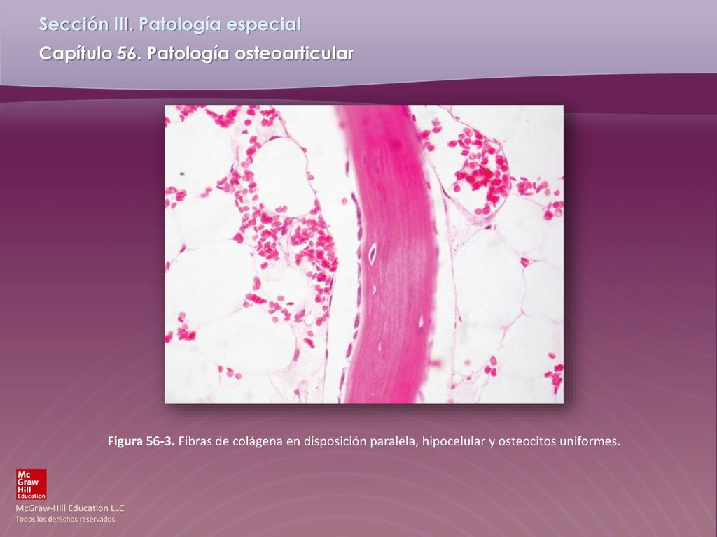 Figura Fibras de colágena en disposición paralela, hipocelular y osteocitos uniformes.