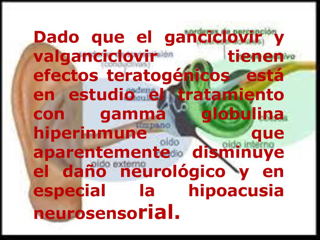 Dado que el ganciclovir y valganciclovir tienen efectos teratogénicos está en estudio el tratamiento con gamma globulina hiperinmune que aparentemente disminuye el daño neurológico y en especial la hipoacusia neurosensorial.