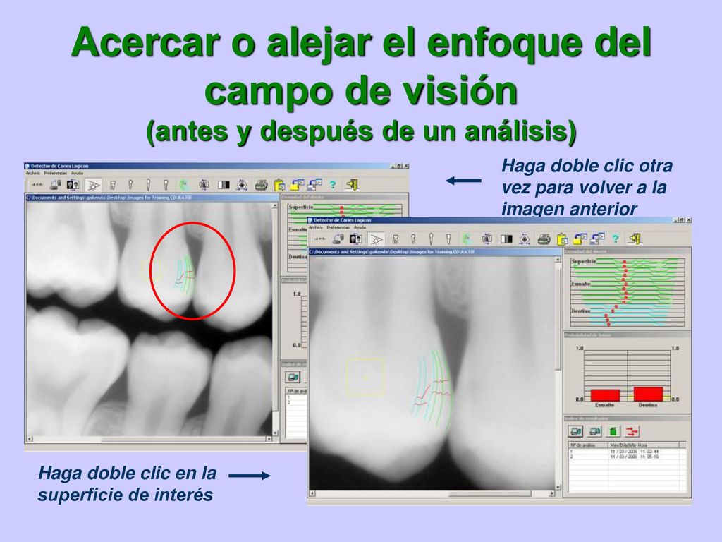 Acercar o alejar el enfoque del campo de visión (antes y después de un análisis)