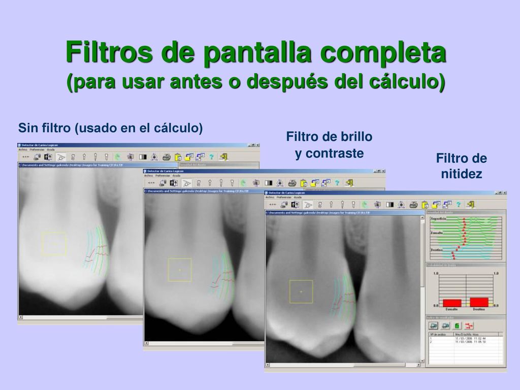 Filtros de pantalla completa (para usar antes o después del cálculo)