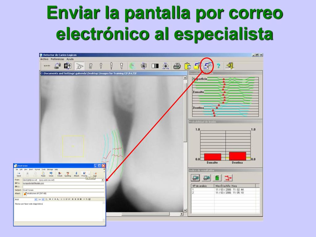 Enviar la pantalla por correo electrónico al especialista
