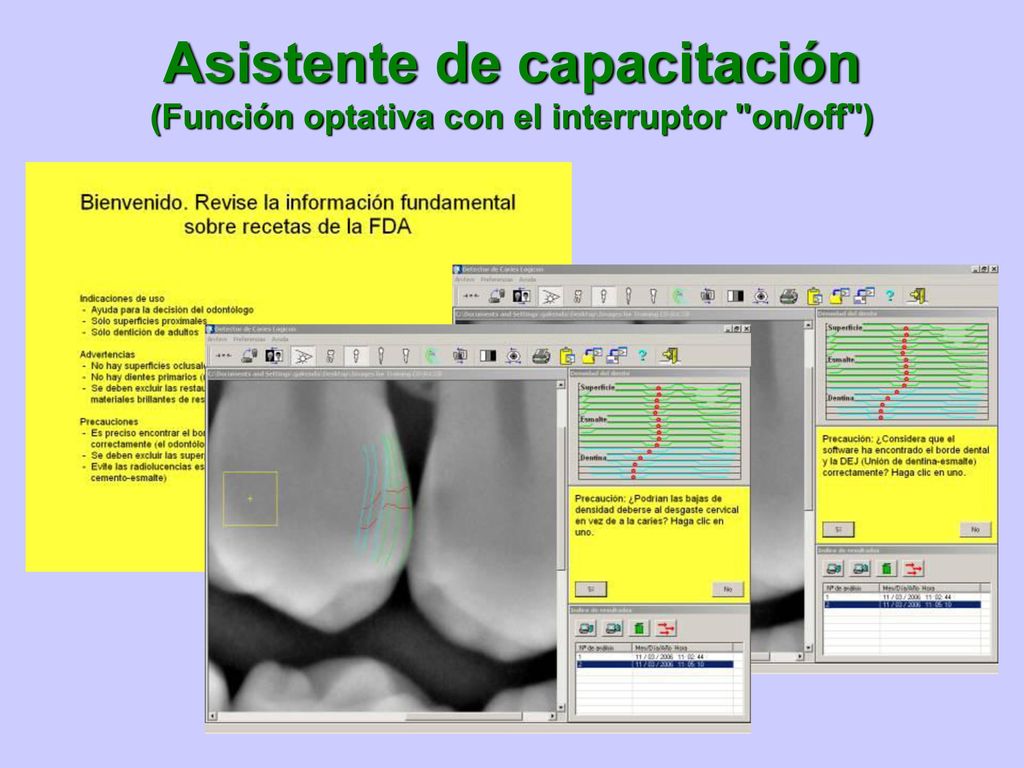 Asistente de capacitación (Función optativa con el interruptor on/off )