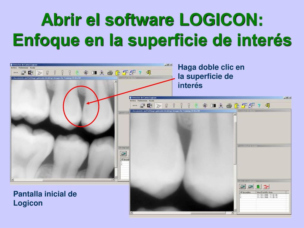Abrir el software LOGICON: Enfoque en la superficie de interés