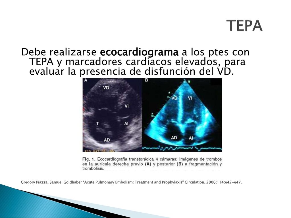 TEPA Debe realizarse ecocardiograma a los ptes con TEPA y marcadores cardíacos elevados, para evaluar la presencia de disfunción del VD.