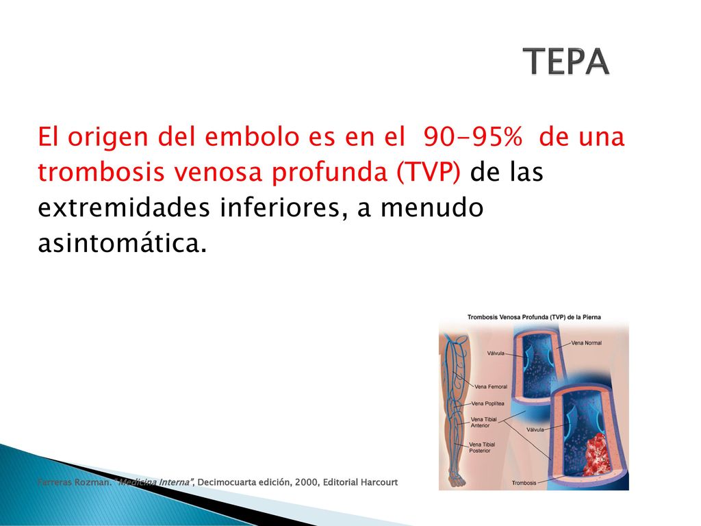 TEPA El origen del embolo es en el 90-95% de una