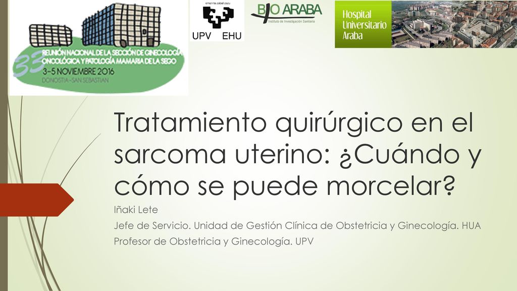 Tratamiento quirúrgico en el sarcoma uterino: ¿Cuándo y cómo se puede morcelar