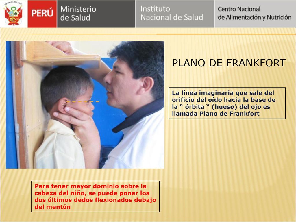 PLANO DE FRANKFORT La línea imaginaria que sale del orificio del oído hacia la base de la órbita (hueso) del ojo es llamada Plano de Frankfort.