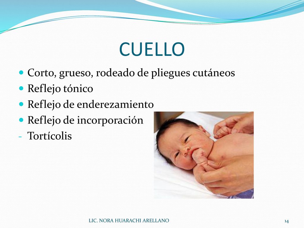 CUELLO Corto, grueso, rodeado de pliegues cutáneos Reflejo tónico