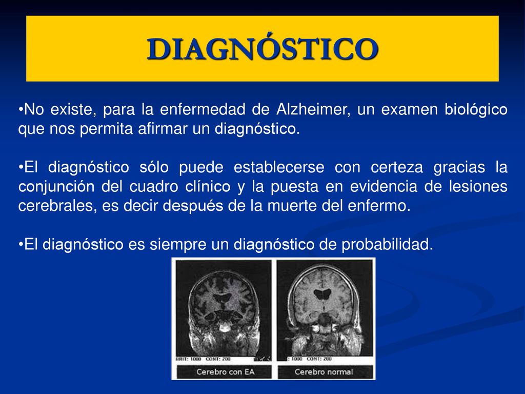 DIAGNÓSTICO No existe, para la enfermedad de Alzheimer, un examen biológico que nos permita afirmar un diagnóstico.