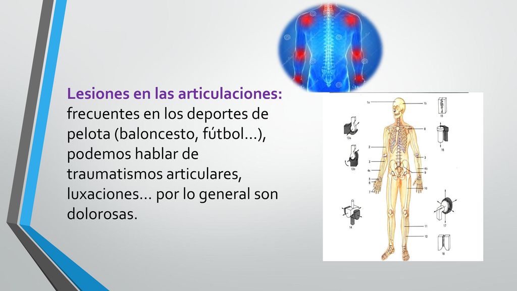 Lesiones en las articulaciones: frecuentes en los deportes de pelota (baloncesto, fútbol…), podemos hablar de traumatismos articulares, luxaciones...