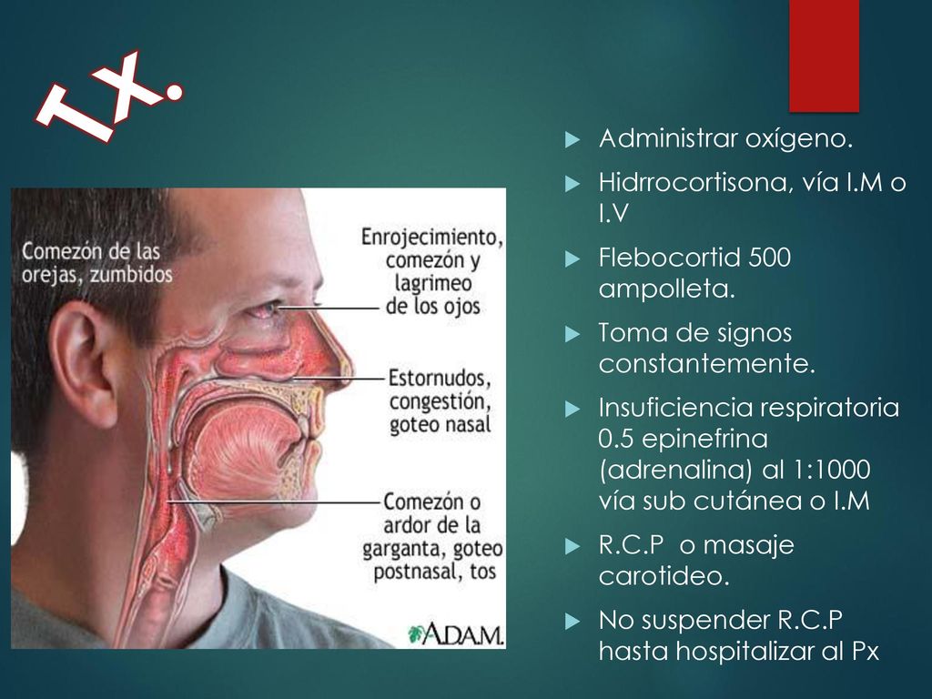 Tx. Administrar oxígeno. Hidrrocortisona, vía I.M o I.V