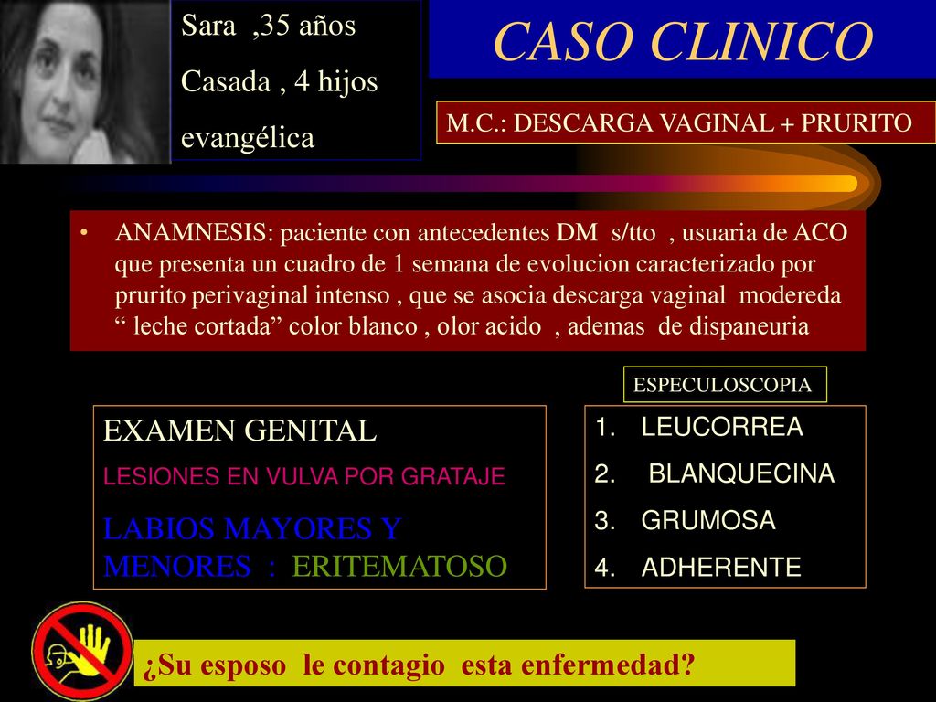 CASO CLINICO Sara ,35 años Casada , 4 hijos evangélica EXAMEN GENITAL