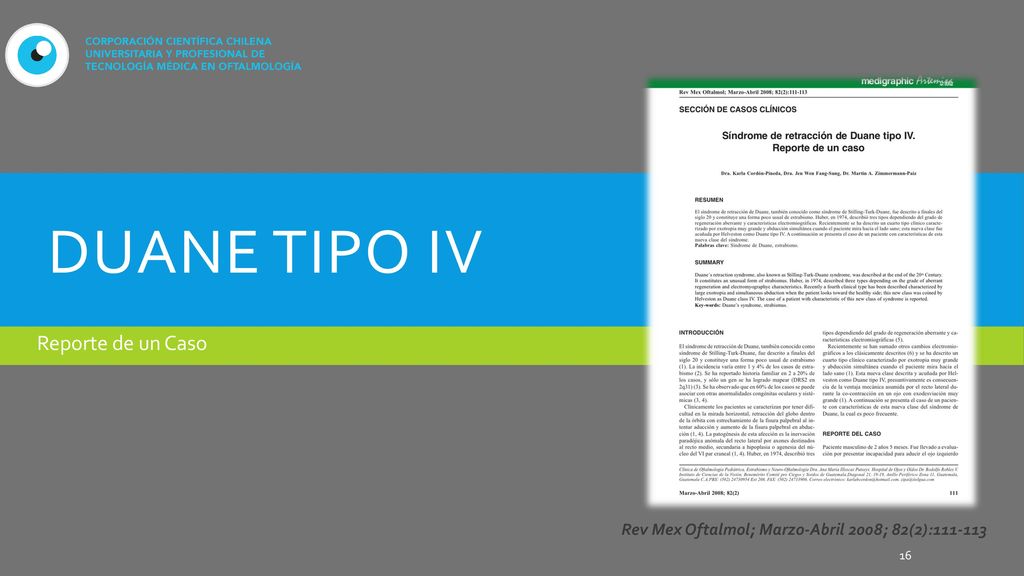 Duane tipo IV Reporte de un Caso