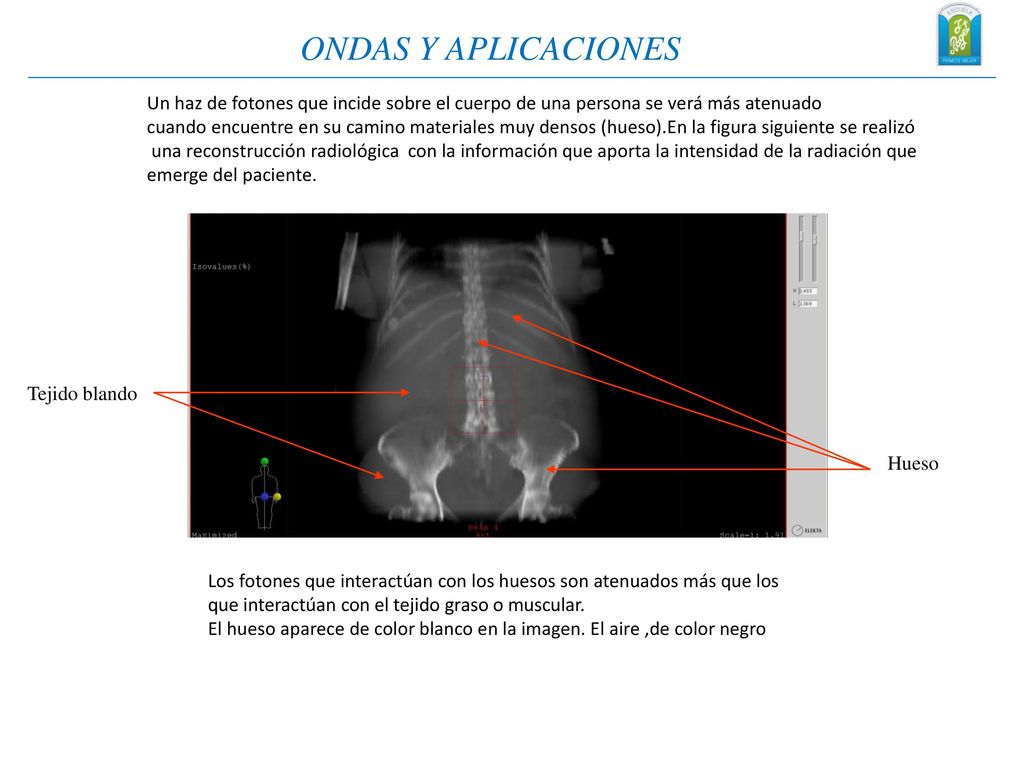ONDAS Y APLICACIONES Un haz de fotones que incide sobre el cuerpo de una persona se verá más atenuado.