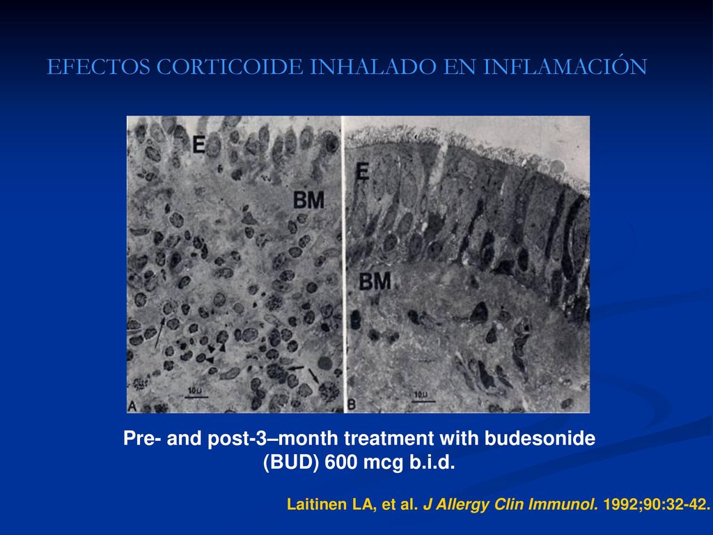 Pre- and post-3–month treatment with budesonide (BUD) 600 mcg b.i.d.