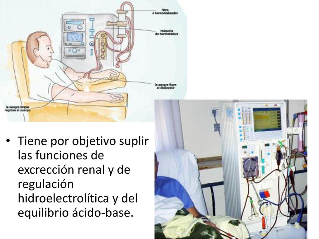 Tiene por objetivo suplir las funciones de excrección renal y de regulación hidroelectrolítica y del equilibrio ácido-base.