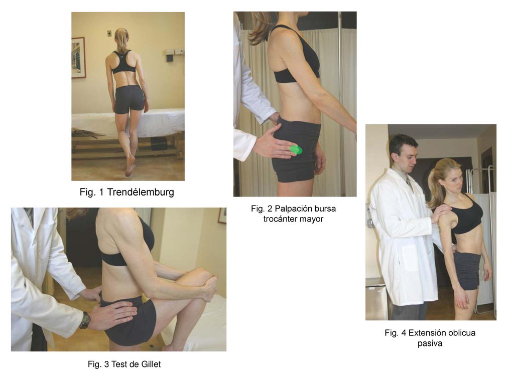 Fig. 1 Trendélemburg Fig. 2 Palpación bursa trocánter mayor