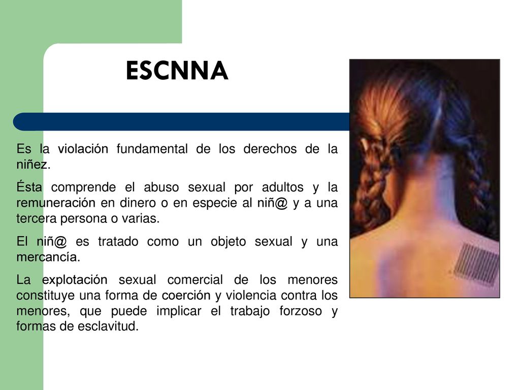 ESCNNA Es la violación fundamental de los derechos de la niñez.