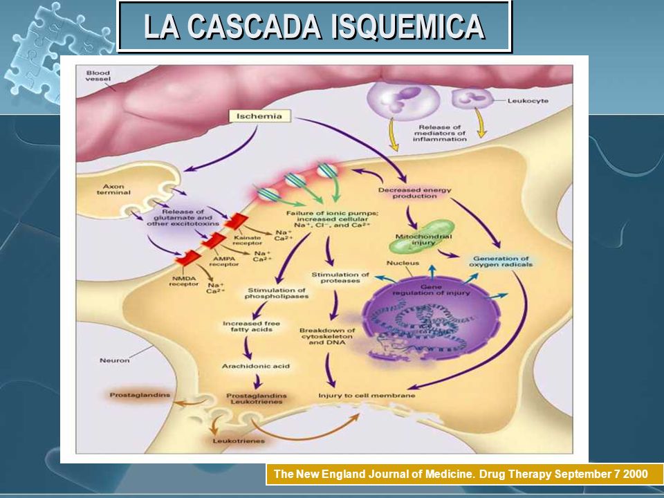 LA CASCADA ISQUEMICA The New England Journal of Medicine. Drug Therapy September