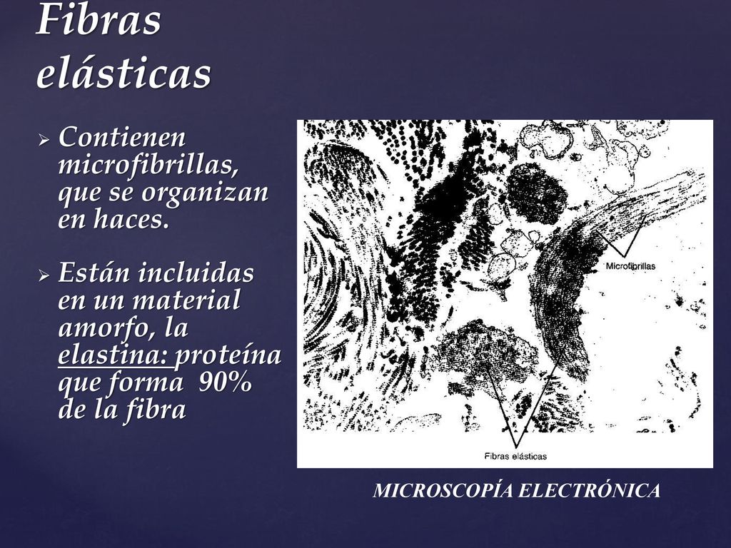 Fibras elásticas Contienen microfibrillas, que se organizan en haces.