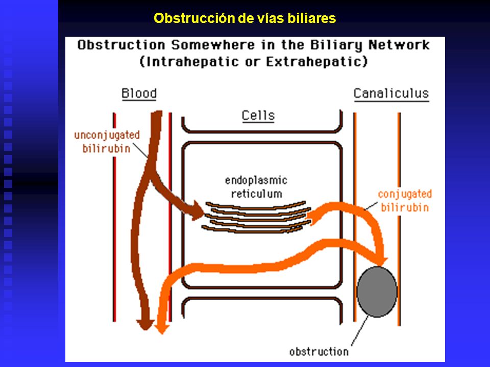 Obstrucción de vías biliares