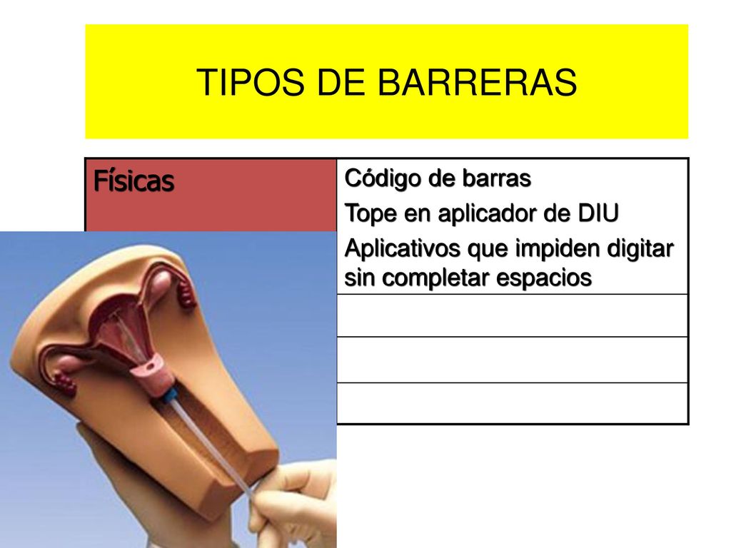 TIPOS DE BARRERAS Físicas Naturales Acción humana Administrativas