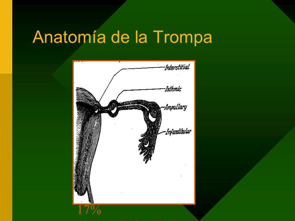 Anatomía de la Trompa 95% Tubárico -55% ampular % itsmico