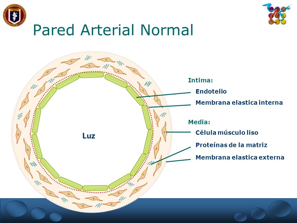 Pared Arterial Normal Luz Intima: Endotelio Membrana elastica interna