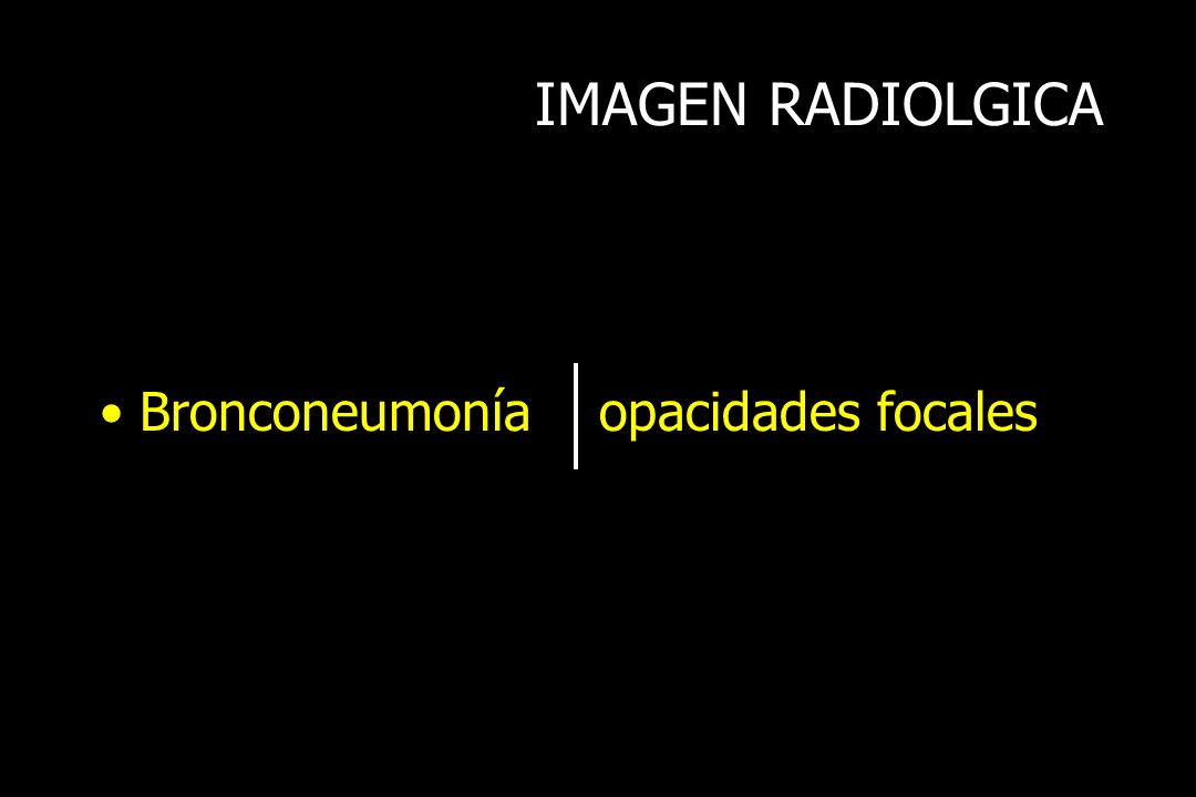 IMAGEN RADIOLGICA Bronconeumonía opacidades focales