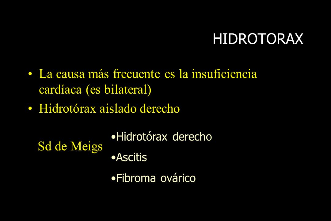 HIDROTORAX La causa más frecuente es la insuficiencia cardíaca (es bilateral) Hidrotórax aislado derecho.