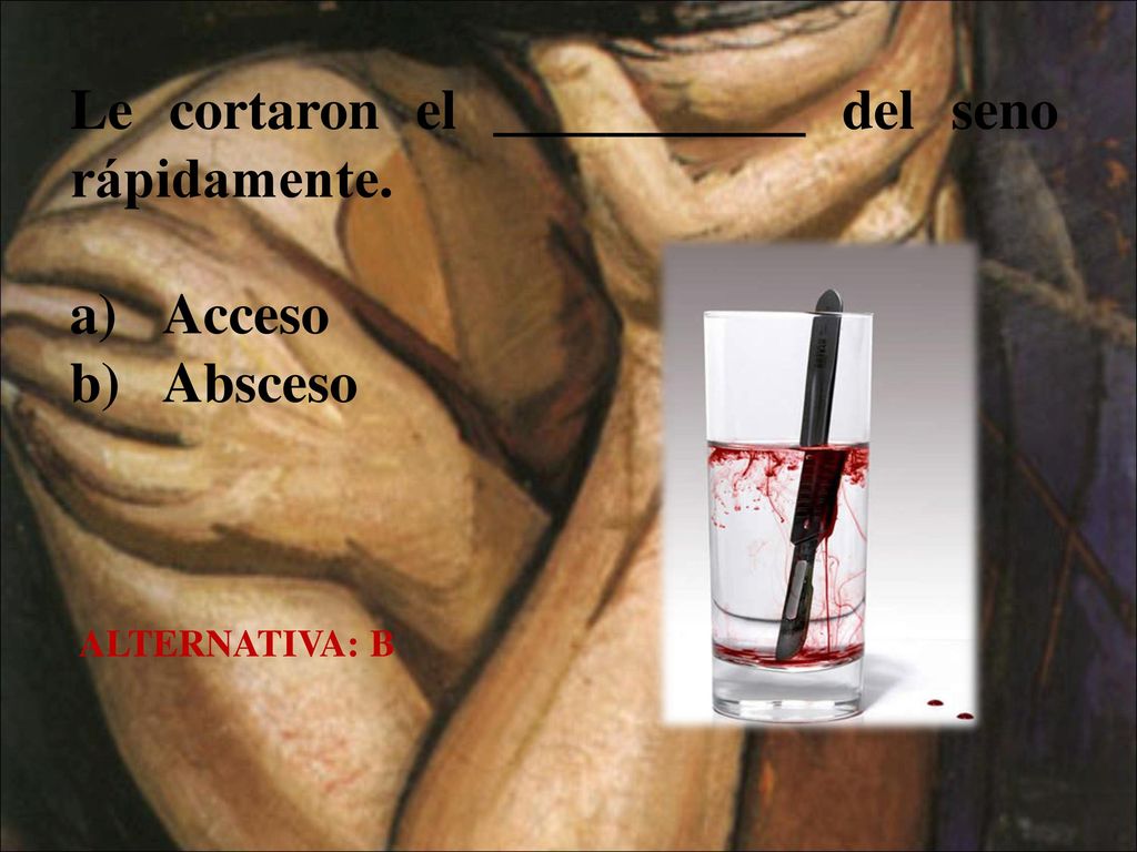 Le cortaron el ___________ del seno rápidamente.