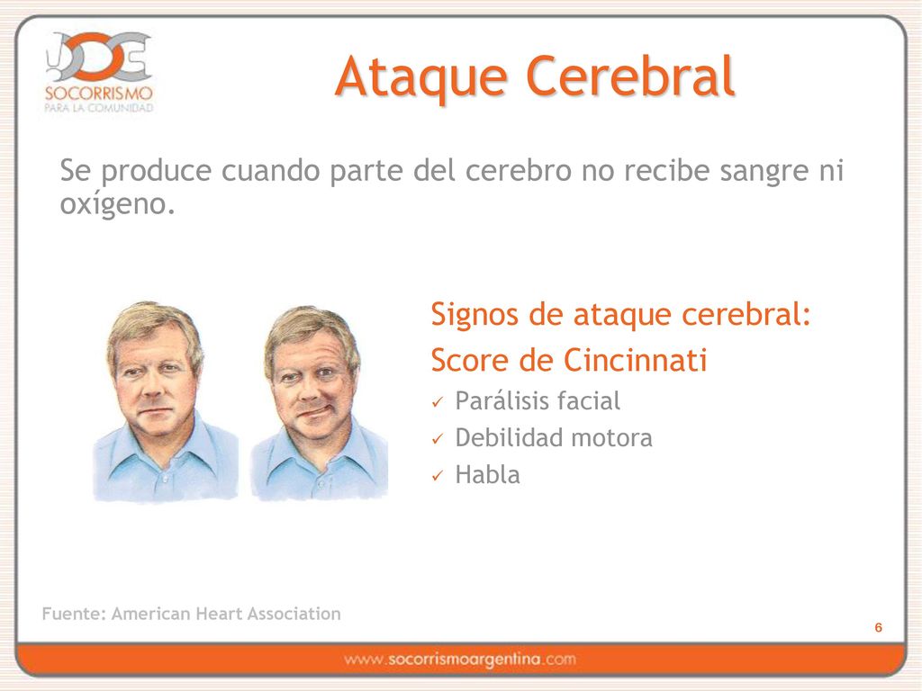 Ataque Cerebral Signos de ataque cerebral: Score de Cincinnati