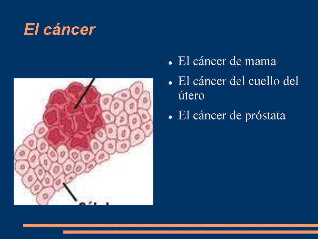 El cáncer El cáncer de mama El cáncer del cuello del útero