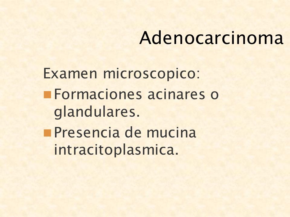 Adenocarcinoma Examen microscopico: