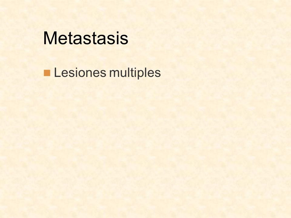 Metastasis Lesiones multiples