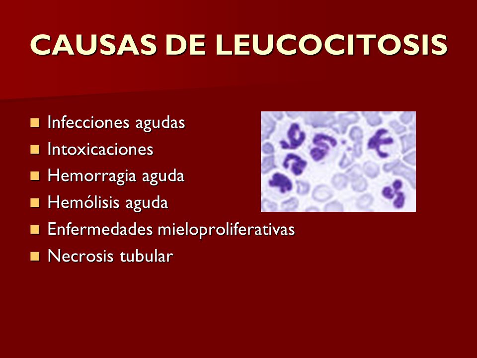 CAUSAS DE LEUCOCITOSIS