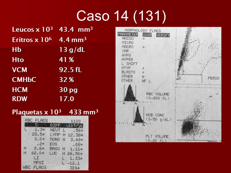 Caso 14 (131) Leucos x mm3 Eritros x mm3 Hb 13 g/dL